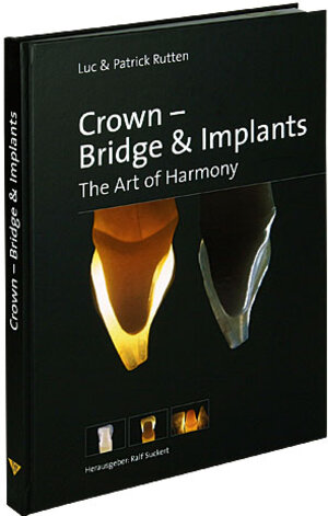 Buchcover Crown - Bridge & Implants | Luc Rutten | EAN 9783932599170 | ISBN 3-932599-17-9 | ISBN 978-3-932599-17-0