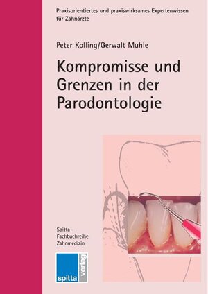 Kompromisse und Grenzen in der Parodontologie