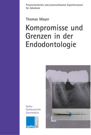 Kompromisse und Grenzen in der Endodontologie