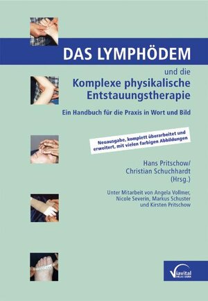 Buchcover Das Lymphödem und die Komplexe physikalische Entstauungstherapie | Angela Vollmer | EAN 9783934371323 | ISBN 3-934371-32-9 | ISBN 978-3-934371-32-3