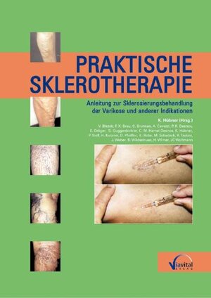 Praktische Sklerotherapie: Anleitung zur Sklerosierungsbehandlung der Varikose und anderer Indikationen