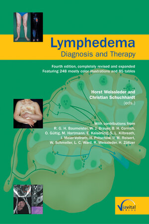 Buchcover Lymphedema - Diagnosis and Therapy | R G Baumeister | EAN 9783934371385 | ISBN 3-934371-38-8 | ISBN 978-3-934371-38-5