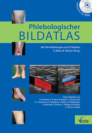 Buchcover Phlebologischer Bildatlas  | EAN 9783934371521 | ISBN 3-934371-52-3 | ISBN 978-3-934371-52-1