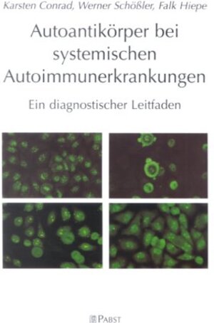 Buchcover Autoantikörper bei systemischen Autoimmunerkrankungen | Karsten Conrad | EAN 9783935357142 | ISBN 3-935357-14-1 | ISBN 978-3-935357-14-2