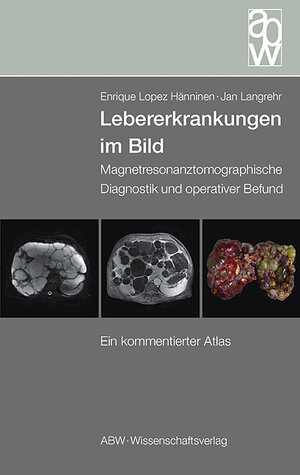 Buchcover Lebererkrankungen im Bild | Enrique Lopez Hänninen | EAN 9783936072587 | ISBN 3-936072-58-2 | ISBN 978-3-936072-58-7