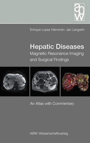 Buchcover Hepatic Diseases | Enrique Lopez Hänninen | EAN 9783936072600 | ISBN 3-936072-60-4 | ISBN 978-3-936072-60-0