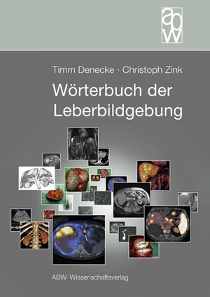 Buchcover Wörterbuch der Leberbildgebung | Timm Denecke | EAN 9783936072907 | ISBN 3-936072-90-6 | ISBN 978-3-936072-90-7