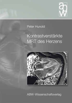 Buchcover Kontrastverstärkte MRT des Herzens | Peter Hunold | EAN 9783936072990 | ISBN 3-936072-99-X | ISBN 978-3-936072-99-0