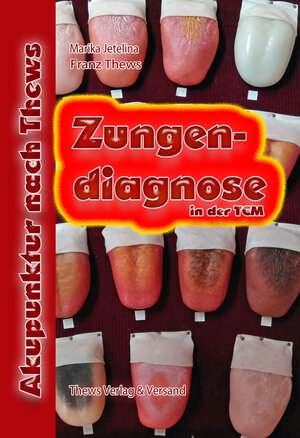 Buchcover Zungendiagnose in 54 Bildern | Franz Thews | EAN 9783936456141 | ISBN 3-936456-14-3 | ISBN 978-3-936456-14-1