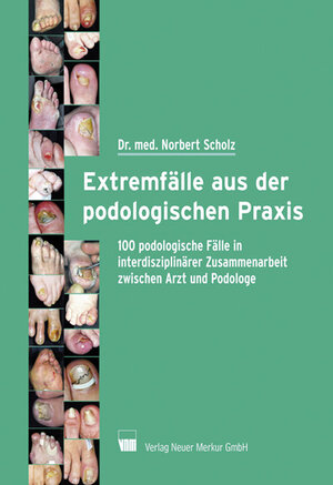 Buchcover Extremfälle aus der podologischen Praxis | Norbert Scholz | EAN 9783937346199 | ISBN 3-937346-19-8 | ISBN 978-3-937346-19-9