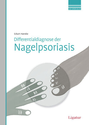Buchcover Differentialdiagnose der Nagelpsoriasis | Eckart Haneke | EAN 9783940407269 | ISBN 3-940407-26-7 | ISBN 978-3-940407-26-9