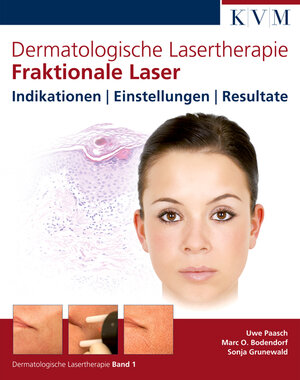 Buchcover Dermatologische Lasertherapie Band 1: Fraktionale Laser | Uwe Paasch | EAN 9783940698179 | ISBN 3-940698-17-2 | ISBN 978-3-940698-17-9