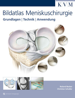 Buchcover Bildatlas Meniskuschirurgie | Roland Becker | EAN 9783940698995 | ISBN 3-940698-99-7 | ISBN 978-3-940698-99-5