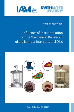 Buchcover Influence of Disc Herniation on the Mechanical Behaviour of the Lumbar Intervertebral Disc | Marzieh Azarnoosh | EAN 9783941704992 | ISBN 3-941704-99-0 | ISBN 978-3-941704-99-2