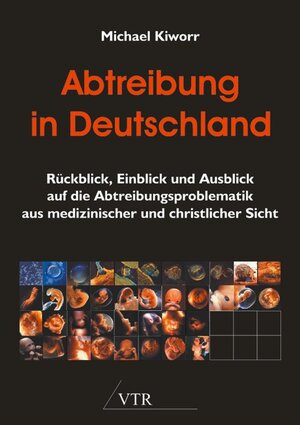Buchcover Abtreibung in Deutschland | Michael Kiworr | EAN 9783941750319 | ISBN 3-941750-31-3 | ISBN 978-3-941750-31-9
