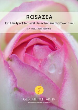 Buchcover Rosazea  | EAN 9783942192644 | ISBN 3-942192-64-0 | ISBN 978-3-942192-64-4