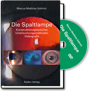 Buchcover Die Spaltlampe | Marcus-Matthias Gellrich | EAN 9783942825009 | ISBN 3-942825-00-7 | ISBN 978-3-942825-00-9