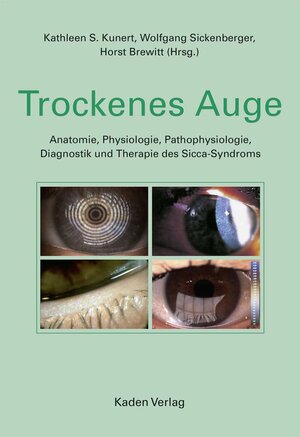 Buchcover Trockenes Auge  | EAN 9783942825481 | ISBN 3-942825-48-1 | ISBN 978-3-942825-48-1