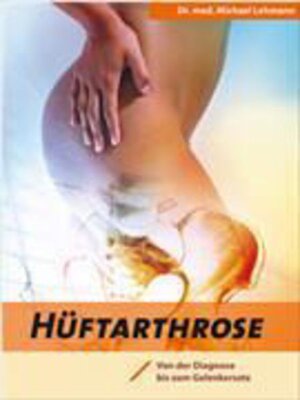 Buchcover Hüftarthrose | Michael Lehmann | EAN 9783943587043 | ISBN 3-943587-04-5 | ISBN 978-3-943587-04-3