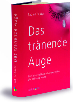 Buchcover Das tränende Auge | Sabine Sauter | EAN 9783944764139 | ISBN 3-944764-13-7 | ISBN 978-3-944764-13-9