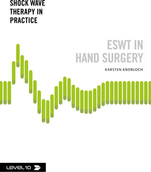 Buchcover ESWT in Hand Surgery | Karsten Knobloch | EAN 9783945106112 | ISBN 3-945106-11-7 | ISBN 978-3-945106-11-2