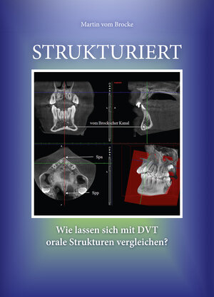 Buchcover Strukturiert | Martin vom Brocke | EAN 9783945127070 | ISBN 3-945127-07-6 | ISBN 978-3-945127-07-0