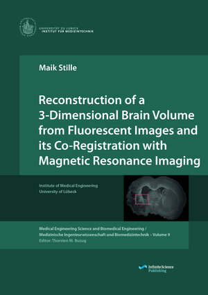 Buchcover Reconstruction of a 3-Dimensional Brain Volume from Fluorescent Images and its Co-Registration with Magnetic Resonance Imaging | Maik Stille | EAN 9783945954102 | ISBN 3-945954-10-X | ISBN 978-3-945954-10-2