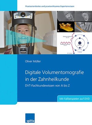 Buchcover Digitale Volumentomografie in der Zahnheilkunde | Oliver Müller | EAN 9783946761501 | ISBN 3-946761-50-X | ISBN 978-3-946761-50-1