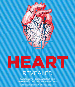 Buchcover The HEART revealed  | EAN 9783950438857 | ISBN 3-9504388-5-8 | ISBN 978-3-9504388-5-7