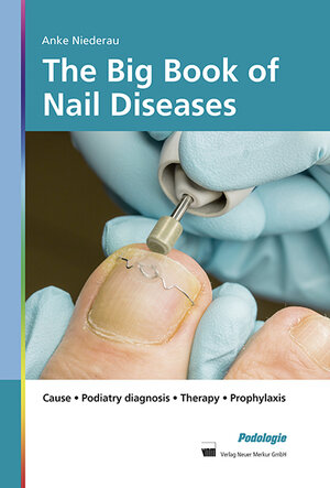 Buchcover The Big Book of Nail Diseases | Anke Niederau | EAN 9783954090495 | ISBN 3-95409-049-X | ISBN 978-3-95409-049-5