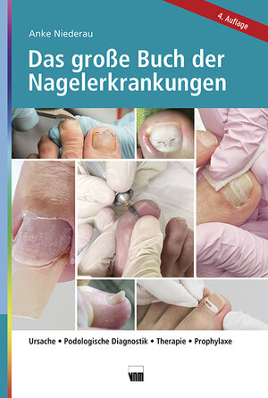 Buchcover Das große Buch der Nagelerkrankungen | Anke Niederau | EAN 9783954090624 | ISBN 3-95409-062-7 | ISBN 978-3-95409-062-4