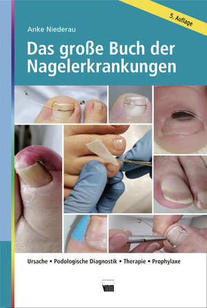 Buchcover Das große Buch der Nagelerkrankungen | Anke Niederau | EAN 9783954098200 | ISBN 3-95409-820-2 | ISBN 978-3-95409-820-0