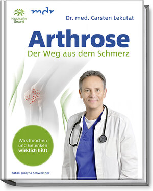 Buchcover Arthrose | Carsten Dr. med. Lekutat | EAN 9783954531554 | ISBN 3-95453-155-0 | ISBN 978-3-95453-155-4