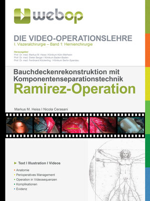 Buchcover Bauchdeckenrekonstruktion mit Komponentenseparationstechnik, Ramirez-Operation | Markus Maria Heiss | EAN 9783955280130 | ISBN 3-95528-013-6 | ISBN 978-3-95528-013-0