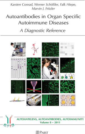Buchcover Autoantibodies in Organ Specific Autoimmune Diseases | Karsten Conrad | EAN 9783958531260 | ISBN 3-95853-126-1 | ISBN 978-3-95853-126-0