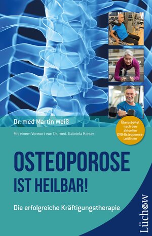 Buchcover Osteoporose ist heilbar! | Dr. med. Martin Weiß | EAN 9783958835009 | ISBN 3-95883-500-7 | ISBN 978-3-95883-500-9