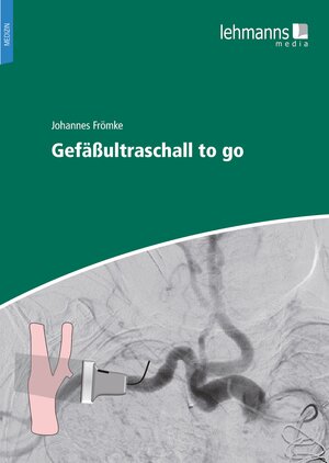 Buchcover Gefäßultraschall to go | Johannes Frömke | EAN 9783965430884 | ISBN 3-96543-088-2 | ISBN 978-3-96543-088-4