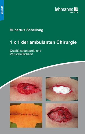 Buchcover 1x1 der ambulanten Chirurgie | Hubertus Schellong | EAN 9783965431409 | ISBN 3-96543-140-4 | ISBN 978-3-96543-140-9