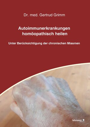 Buchcover Autoimmunerkrankungen homöopathisch heilen | Gertrud Grimm | EAN 9783965431478 | ISBN 3-96543-147-1 | ISBN 978-3-96543-147-8