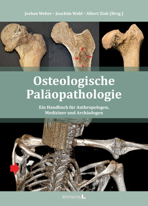 Buchcover Osteologische Paläopathologie  | EAN 9783965433403 | ISBN 3-96543-340-7 | ISBN 978-3-96543-340-3