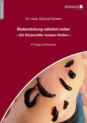 Buchcover Bluteindickung natürlich heilen | Gertrud Grimm | EAN 9783965434066 | ISBN 3-96543-406-3 | ISBN 978-3-96543-406-6