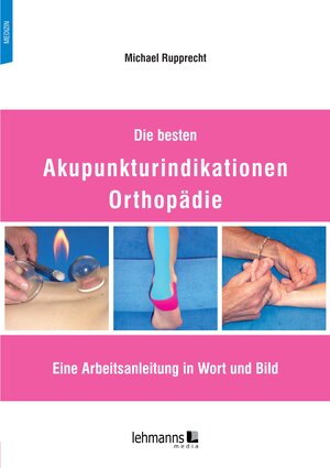 Buchcover Die besten Akupunkturindikationen Orthopädie | Michael Rupprecht | EAN 9783965434127 | ISBN 3-96543-412-8 | ISBN 978-3-96543-412-7