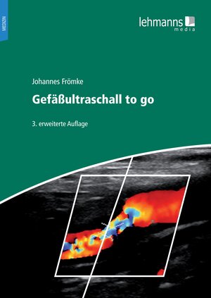 Buchcover Gefäßultraschall to go | Johannes Frömke | EAN 9783965435032 | ISBN 3-96543-503-5 | ISBN 978-3-96543-503-2