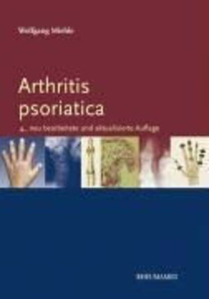 Arthritis psoriatika