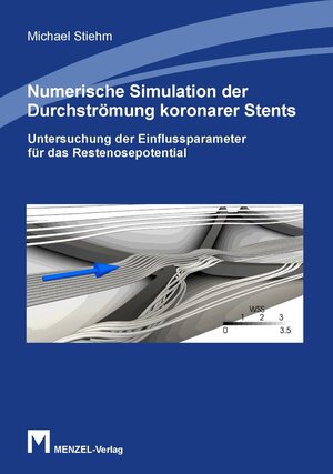 Buchcover Numerische Simulation der Durchströmung koronarer Stents | Michael Stiehm | EAN 9783981344479 | ISBN 3-9813444-7-2 | ISBN 978-3-9813444-7-9