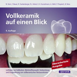 Buchcover Vollkeramik auf einen Blick | Matthias Kern | EAN 9783981701203 | ISBN 3-9817012-0-8 | ISBN 978-3-9817012-0-3