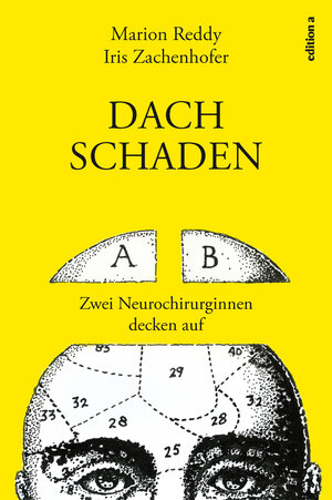 Buchcover Dachschaden | Iris Zachenhofer | EAN 9783990011256 | ISBN 3-99001-125-1 | ISBN 978-3-99001-125-6