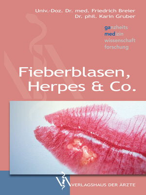 Buchcover Fieberblasen, Herpes & Co. | Friedrich Breier | EAN 9783990520628 | ISBN 3-99052-062-8 | ISBN 978-3-99052-062-8