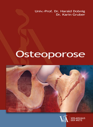 Buchcover Osteoporose | Harald Dobnig | EAN 9783990521311 | ISBN 3-99052-131-4 | ISBN 978-3-99052-131-1