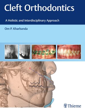 Buchcover Cleft Orthodontics | Om P. Kharbanda | EAN 9788194857082 | ISBN 81-948570-8-2 | ISBN 978-81-948570-8-2